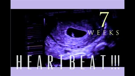 I measured at 6 <b>weeks</b>, 1 day; <b>heartbeat</b> was found, but was only 75BPM. . No heartbeat at 7 weeks success stories ivf
